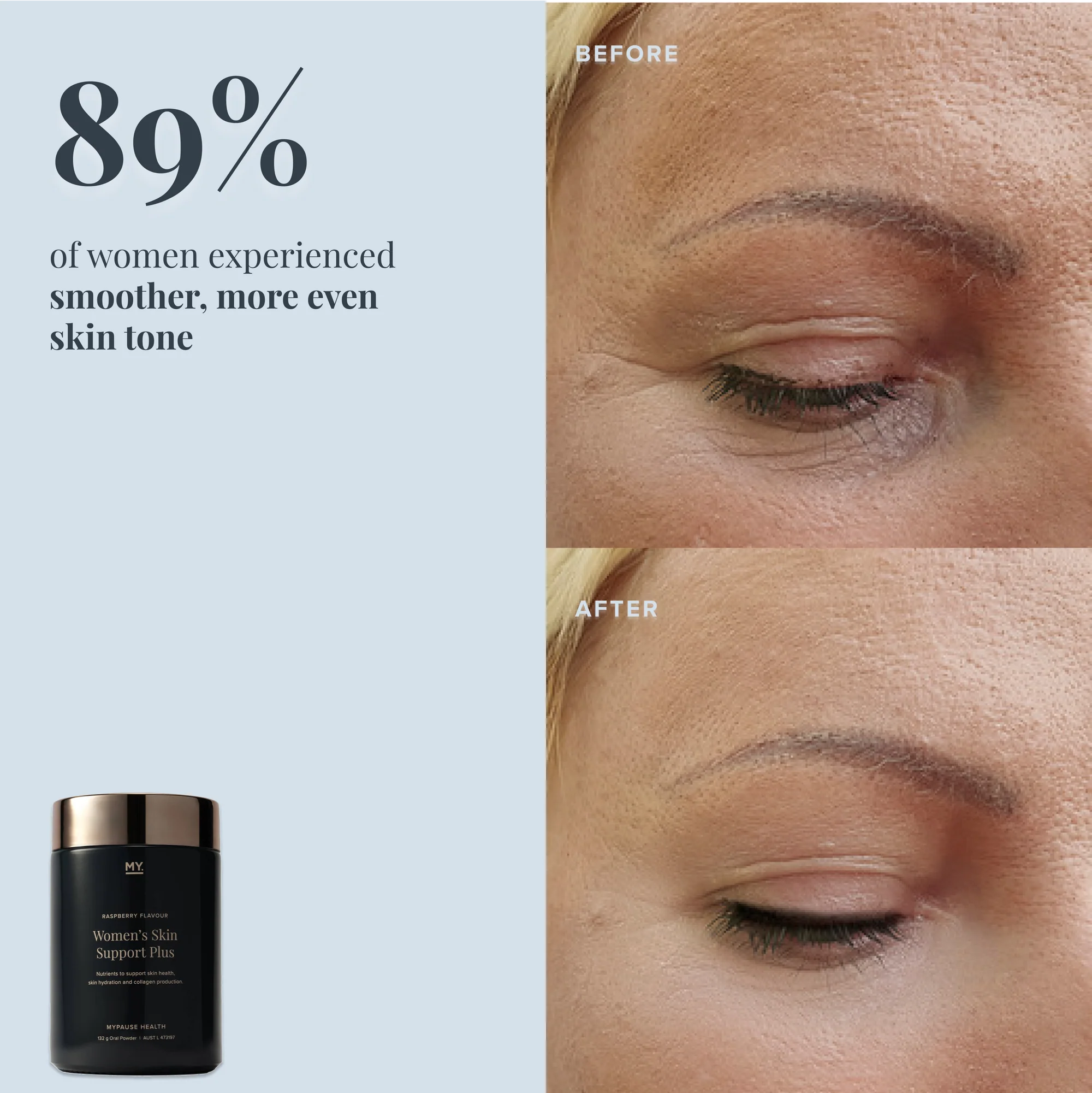 MYPAUSE Women's Skin Support Plus - Image 3